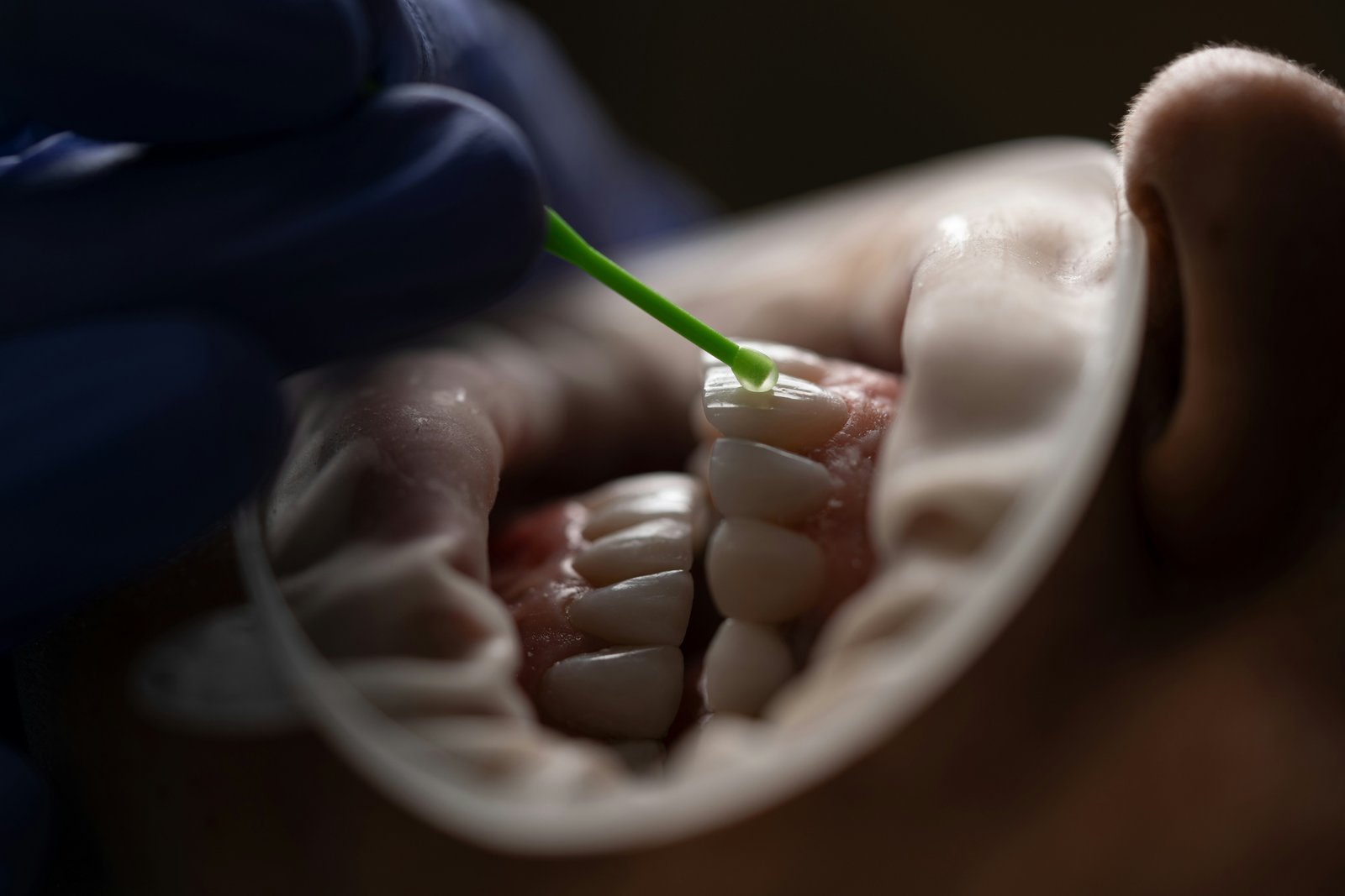 Dental Hygiene