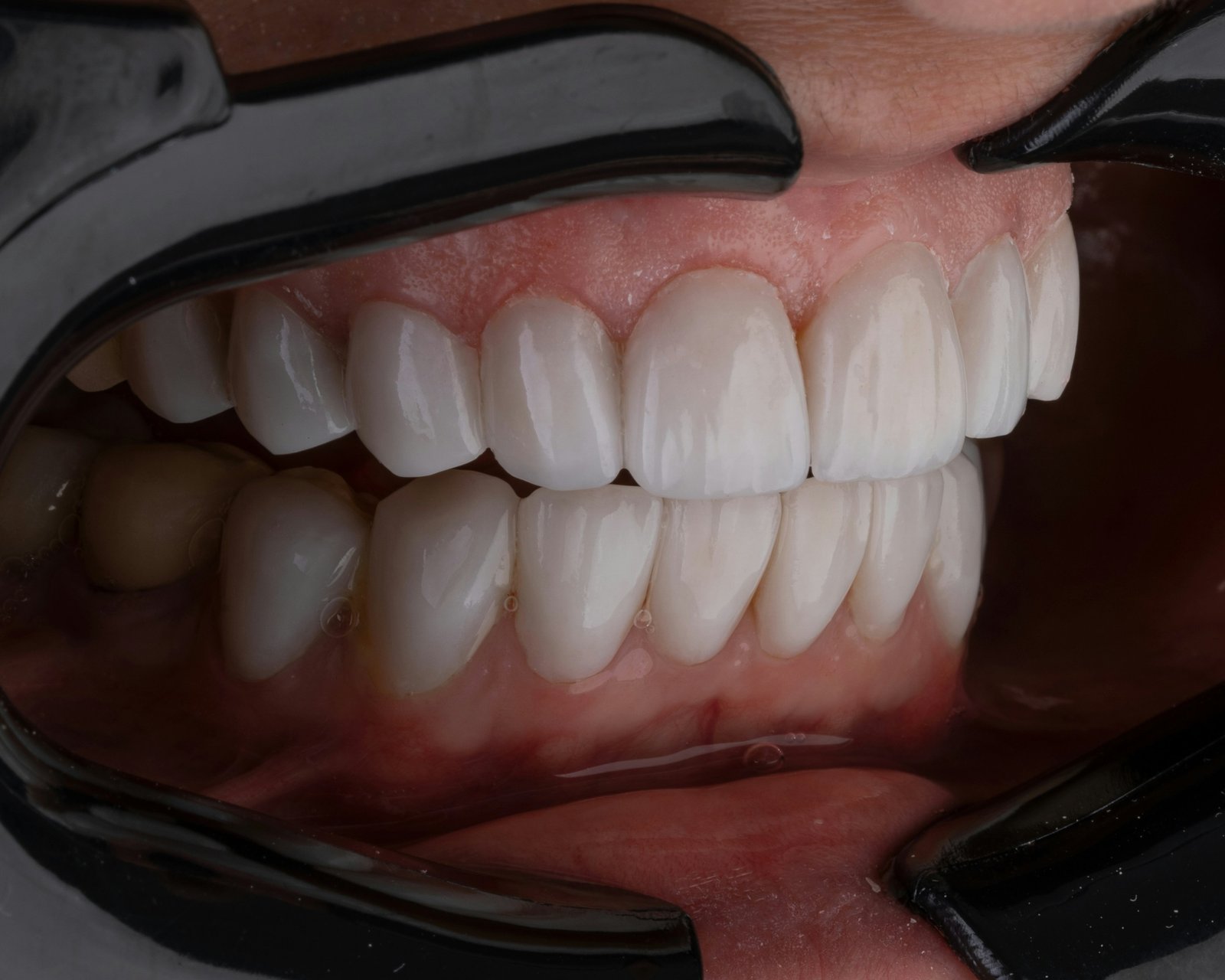 Restorative Dentistry