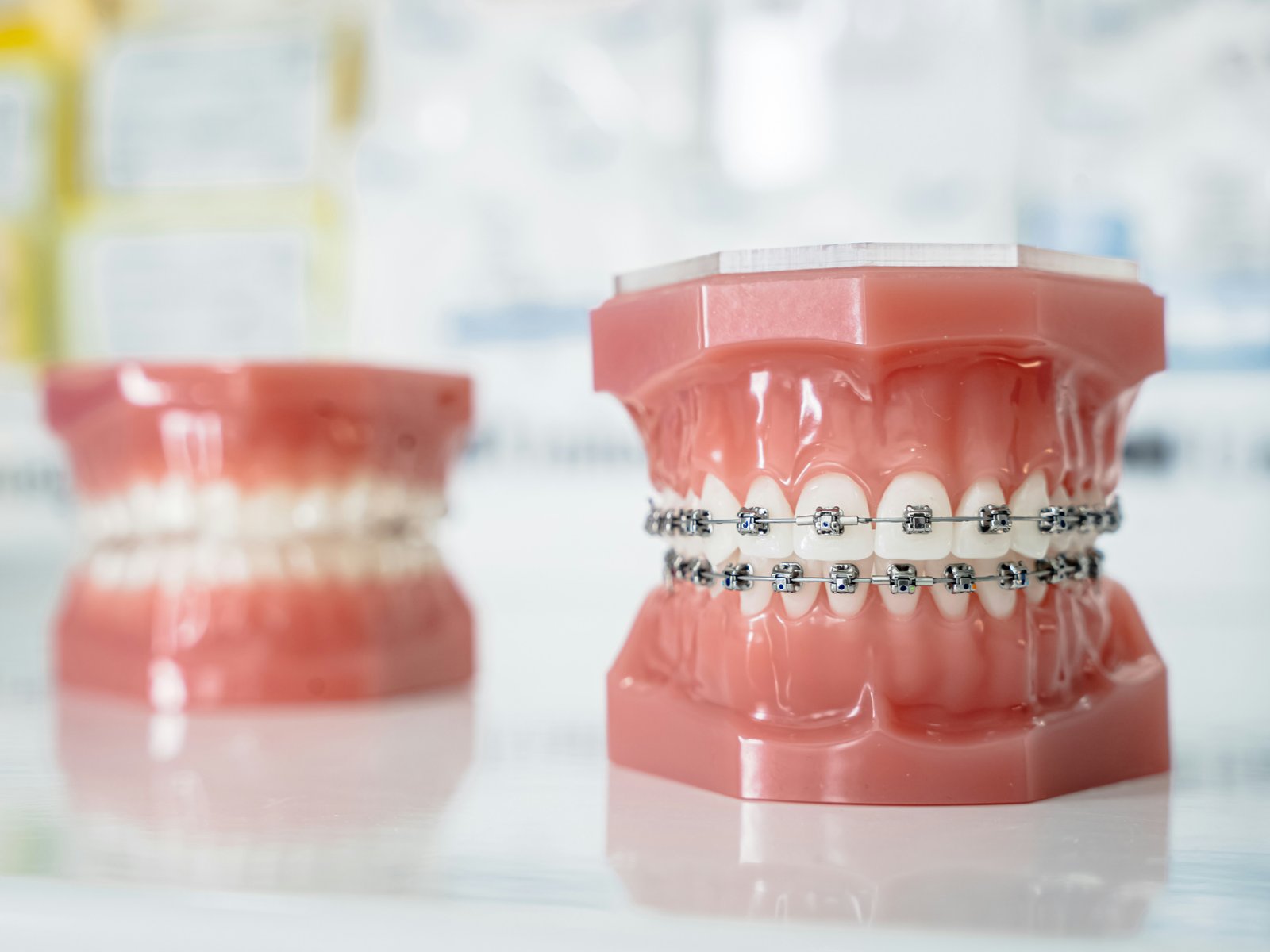 Braces