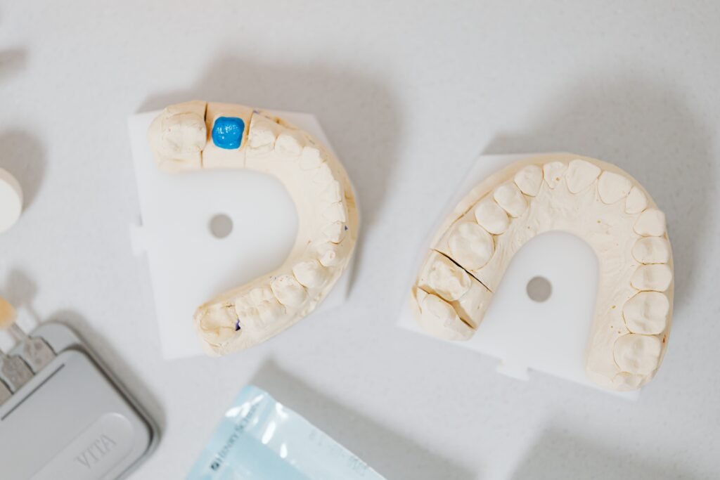 Implant Crown